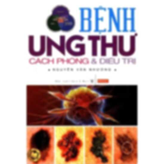Bệnh ung thư cách phòng và điều trị